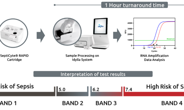 Sepsis Diagnostic Test Outperforms Traditional Biomarkers in ICU Study