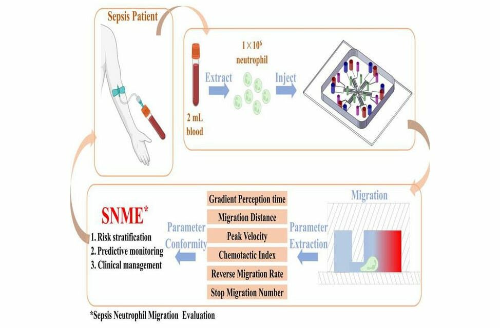 New Microfluidic Chip Tech Offers Improved Sepsis Prognosis