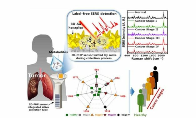 Researchers Develop AI-Powered Sensor for Non-Invasive Cancer Diagnosis Using Body Fluids