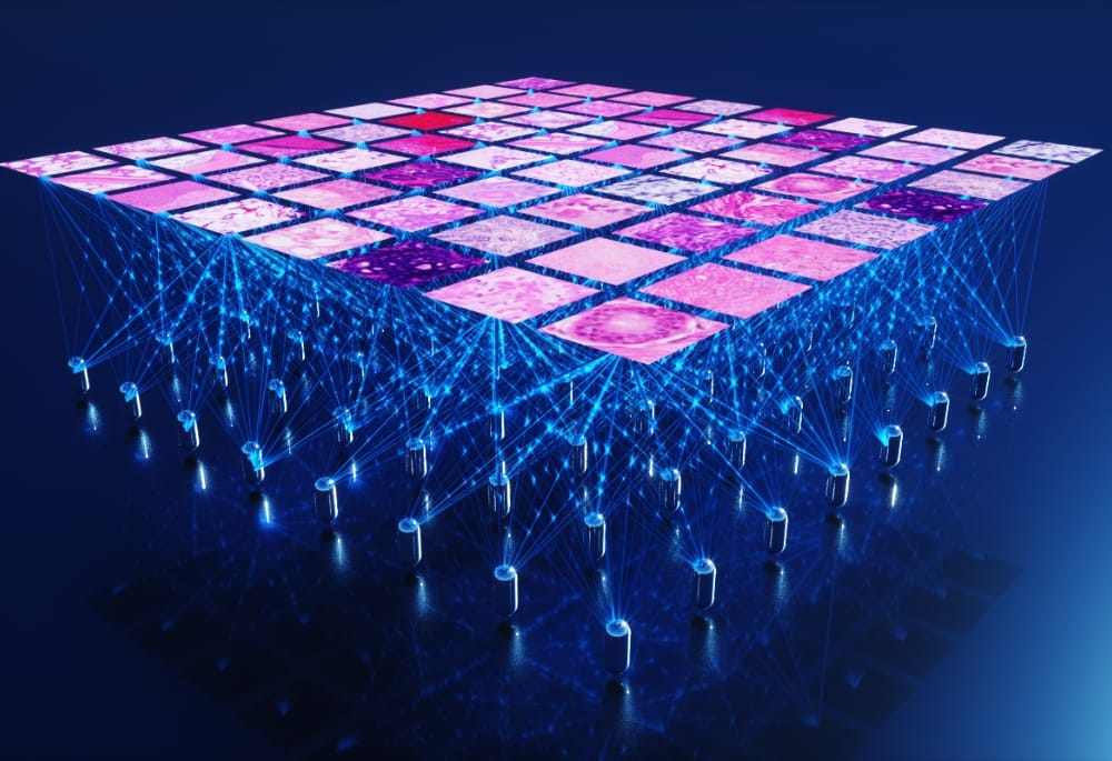 Proscia Expands Concentriq Platform to Accelerate AI-Driven Pathology ...