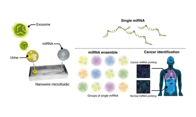 Nanowire-Based Urine Test with AI Detects Early-Stage Lung Cancer with High Accuracy