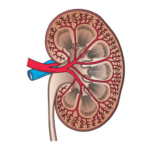 New Non-Invasive Biosensor Aids Early Kidney Disease Detection