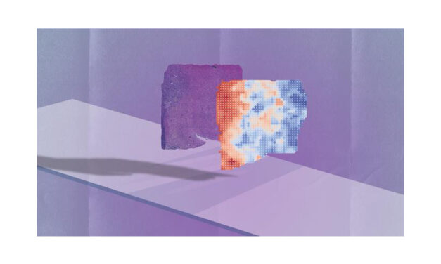 AI-Powered Tool Predicts Cancer Gene Activity from Biopsy Images