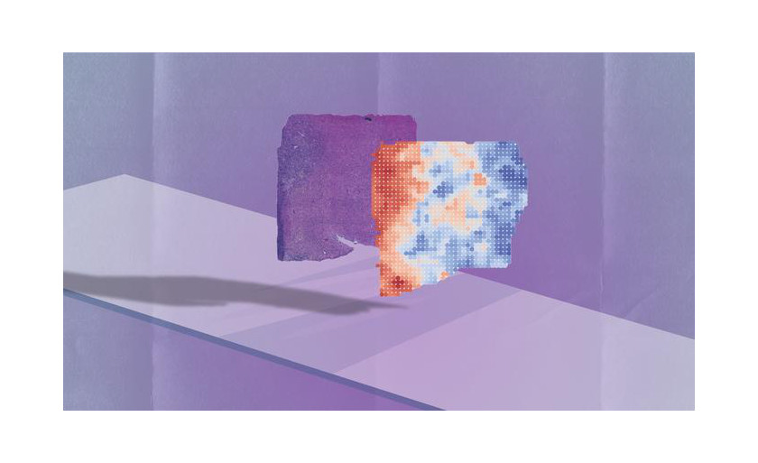 AI-Powered Tool Predicts Cancer Gene Activity from Biopsy Images