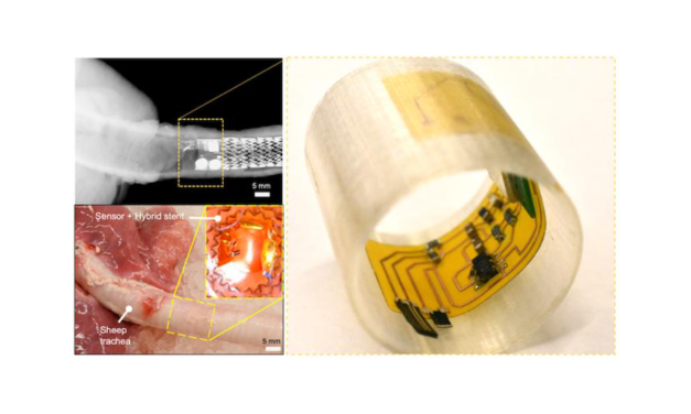 Researchers Develop Robotic Sensory Cilia that Detect Airway Diseases