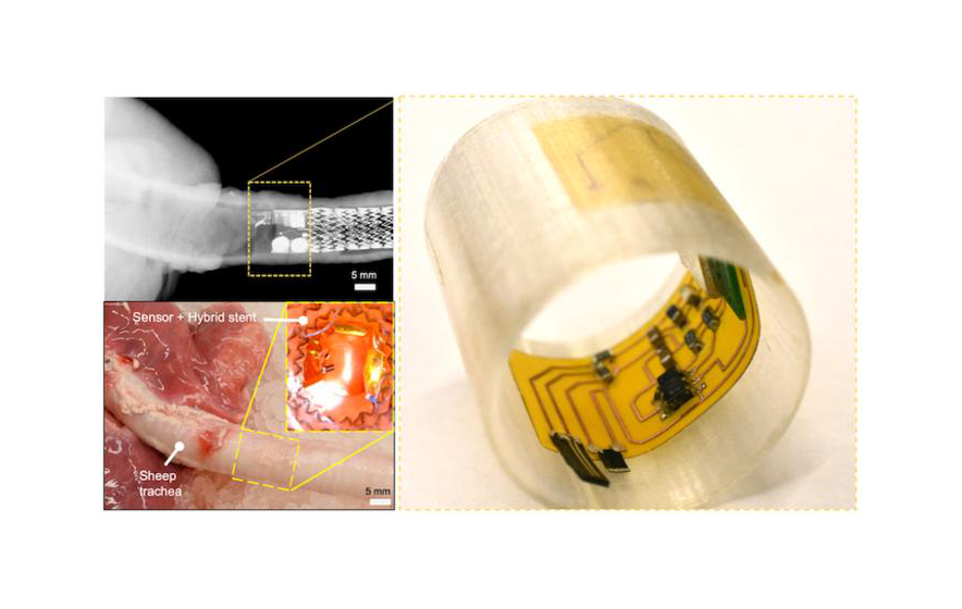Researchers Develop Robotic Sensory Cilia that Detect Airway Diseases