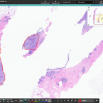 Indica Labs’ Deploys Digital Pathology Solution