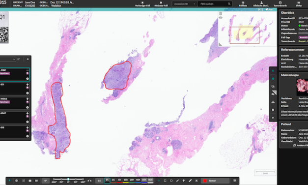 Indica Labs’ Deploys Digital Pathology Solution
