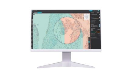 New AI Model Improves Immunohistochemistry Cancer Analysis with Superior Generalization