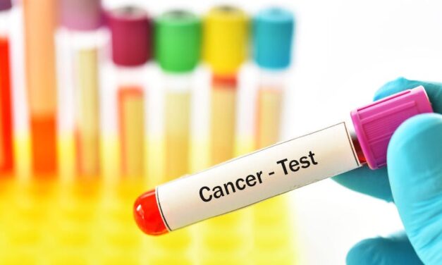 Pancreatic Cancer Test Tapped for Landmark UK Study