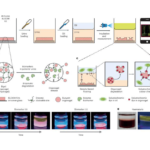 Home Test Kit Detects Bladder Cancer with 88.8% Accuracy