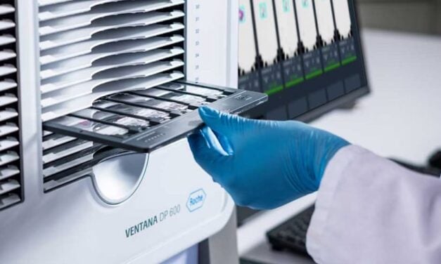 Roche’s Digital Pathology System Gets New FDA Clearance for High-Volume Slide Scanner