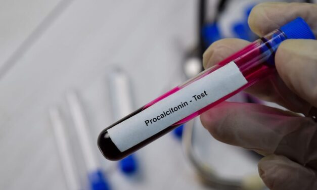 Procalcitonin Test Fails to Reduce Antibiotic Treatment Duration in Hospitalized Children