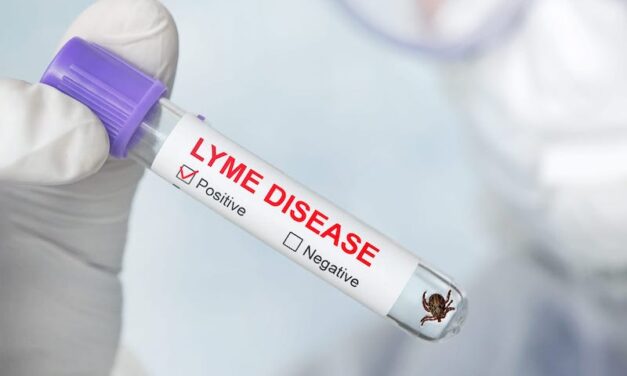 Lyme Disease: Are we Close to an Effective Diagnostic Test?