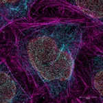 Leica Microsystems Acquires ATTO-TEC to Advance Microscopy Imaging Workflows
