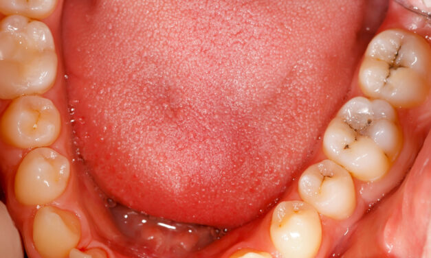 Mouth Bacteria May Give Window into Future Brain Function