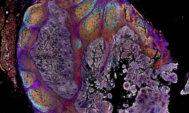 Spatial Imaging System Enables Generation of High-quality Data