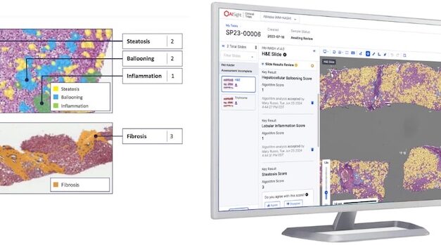 PathAI Announces EMA Qualification for AIM-MASH AI Assist