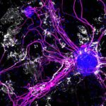 IL-12 Is the Messenger Fueling Alzheimer’s