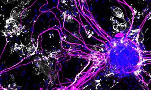 IL-12 Is the Messenger Fueling Alzheimer’s
