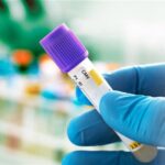 Bio-Rad 40 Exact Diagnostics-Branded Infectious Disease Molecular QC Products Receive IVDR Quality Certificate