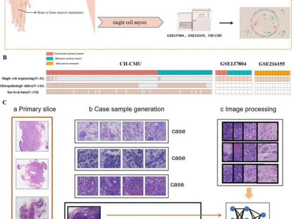 Neuroblastoma Diagnostics Driven by Artificial Intelligence