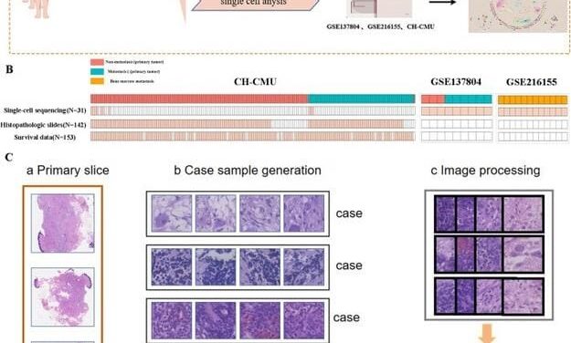 Neuroblastoma Diagnostics Driven by Artificial Intelligence