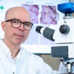 P-tau not as Disease-Specific for Alzheimer’s as Previously Thought