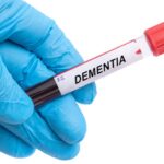 Blood Test May Be Means for Early Detection of Dementia