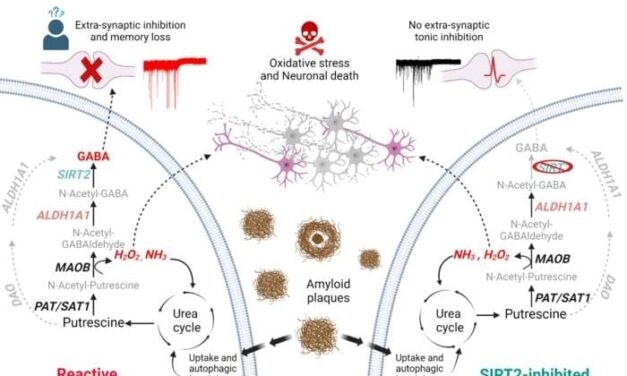 Astrocytes Play Key Role in Alzheimer’s Disease