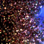 CAP Updates Cancer Protocols to Improve Diagnostic Accuracy
