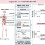 Cancer of Unknown Primary Diagnostics Are Advancing