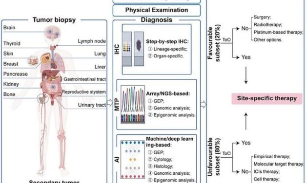 Cancer of Unknown Primary Diagnostics Are Advancing