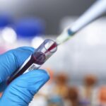 Labcorp Plasma Detect and PGDx Elio Plasma Focus Dx Launched