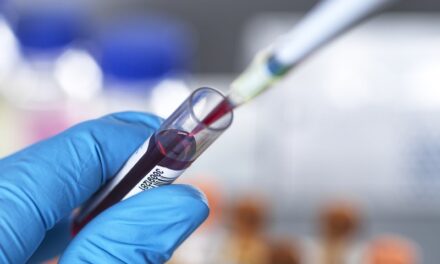 Labcorp Plasma Detect and PGDx Elio Plasma Focus Dx Launched