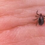 New Strain of Rickettsia Bacteria That Causes Spotted Fever Infections in Humans Identified