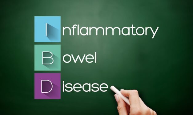European Launch of Calprotectin Immunoturbidimetric Assay Announced