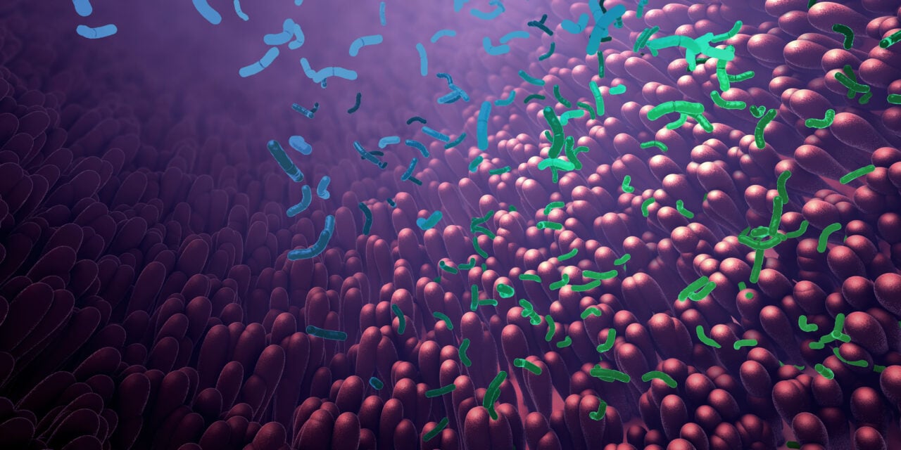 Gut Bacteria and AI Used to Diagnose a Chronic Pain Syndrome