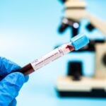 Heart Disease Risk Could Be Predicted with a Simple Test