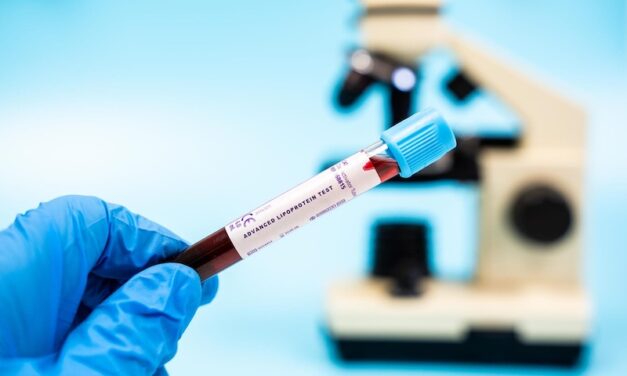 Heart Disease Risk Could Be Predicted with a Simple Test