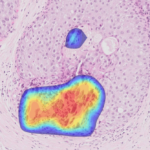 Ibex Breast Demonstrates High Accuracy, Efficiency in Study