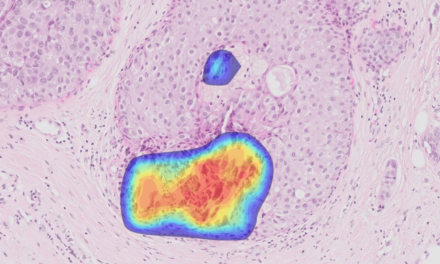 Ibex Breast Demonstrates High Accuracy, Efficiency in Study