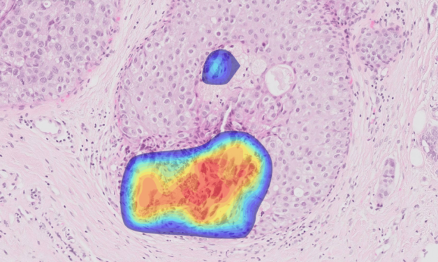 Ibex Breast Demonstrates High Accuracy, Efficiency in Study