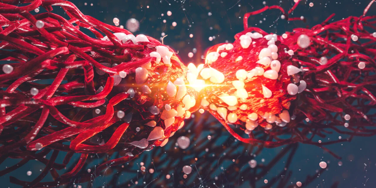 Labcorp Expands Oncology Portfolio
