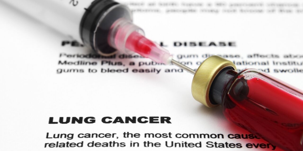 Roche Receives FDA Nod for Lung Cancer Companion Diagnostic
