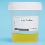 Partnership Enhances Digital Pathology Platform with AI-Powered Urine Cytology Solution