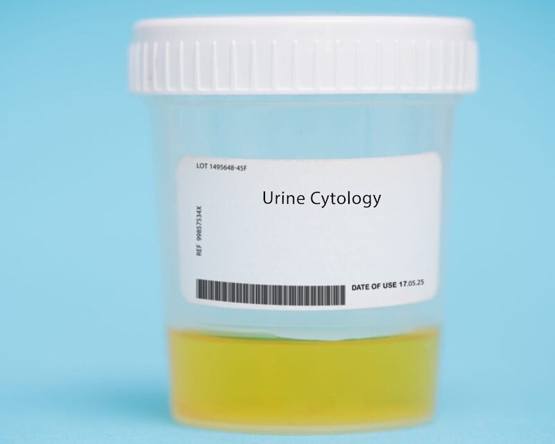 Partnership Enhances Digital Pathology Platform with AI-Powered Urine Cytology Solution