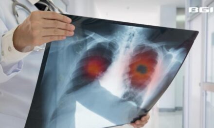 mNGS Test Detects Three Times More Lung Pathogens Than Traditional Methods