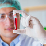 Quest Diagnostics to Develop MCaST Blood Test