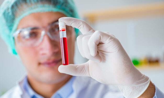 Quest Diagnostics to Develop MCaST Blood Test
